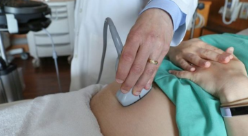 Severe COVID-19 infections linked to higher stillbirth, preterm birth risks: study